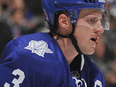 Still no word on extent of Phaneuf